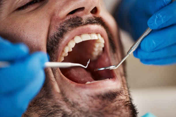 Professional Emergency Dental Service in MS